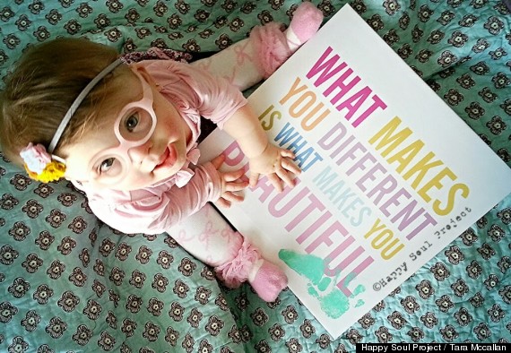 Tara McCallan wants her little girl to know that different is beautiful.2