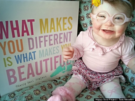 Tara McCallan wants her little girl to know that different is beautiful.