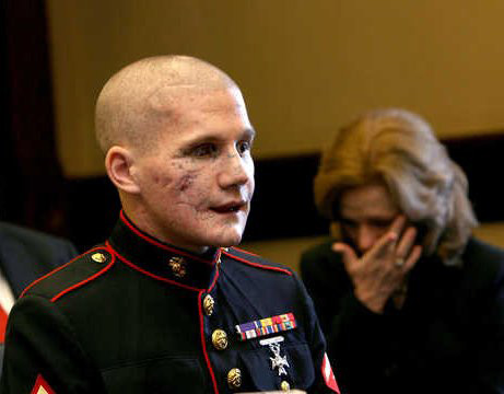 The beautiful face of courage: Lance Cpl. William Kyle Carpenter USMC