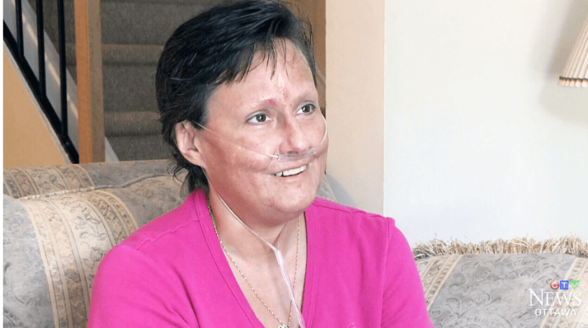 Anonymous stranger gives Ottawa woman $128,000 for life-saving treatment